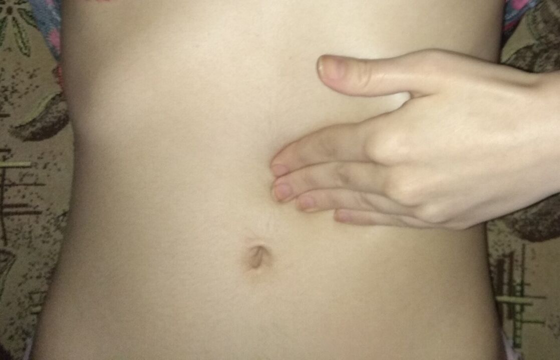 Stomaco sano dopo il trattamento con capsule NEOflorax