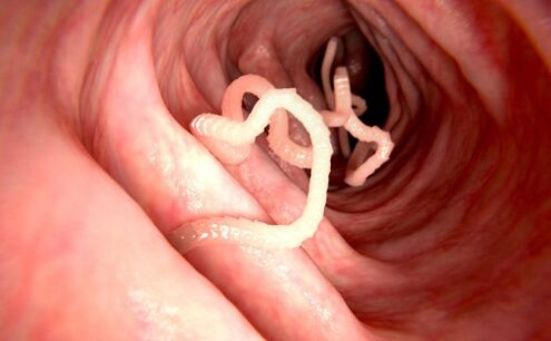 vermi nel corpo umano