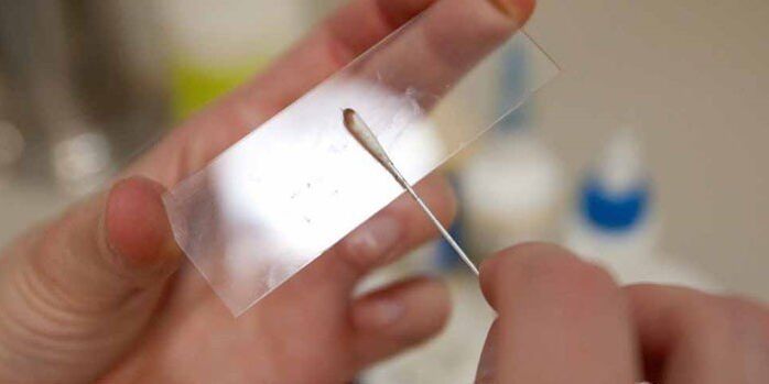 raschiamento della pelle per parassiti