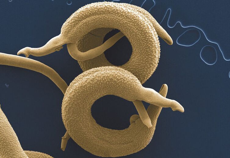 parassiti che vivono nel corpo umano